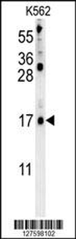 LCE2B Antibody (C-term)