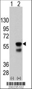 PINK1 Antibody (Ascites)