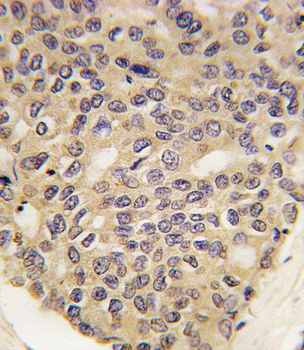 PINK1 Antibody (Ascites)