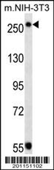 TSC2 Antibody