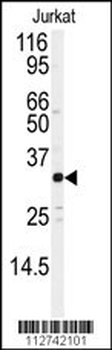 JUND Antibody (S255)