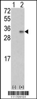 VEGFB (VEGF2) Antibody (Center)