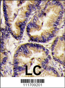 VEGFB (VEGF2) Antibody (Center)