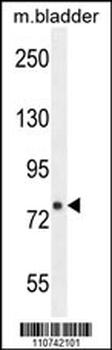 FBXL10b Antibody (N-term)