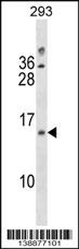 LIMS3/LIMS3L Antibody (Center)