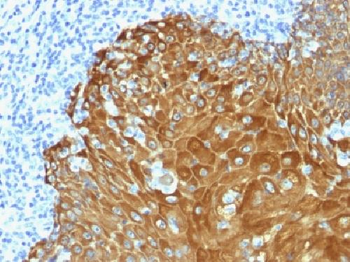 Cytokeratin, pan Antibody