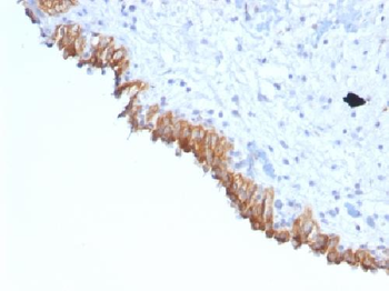 Lewis Y (Tumor Marker) Antibody