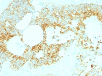 Lewis Y (Tumor Marker) Antibody
