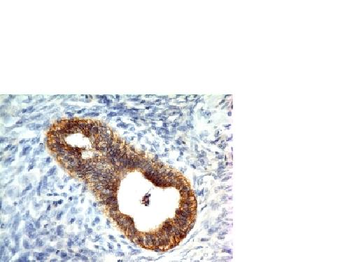 E-Cadherin / CD324 Antibody
