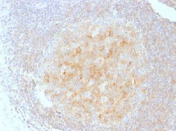 CD40 / TNFRSF5 Antibody