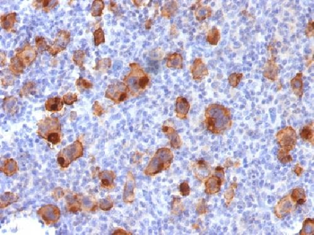 CD30 / TNFRSF8 Antibody