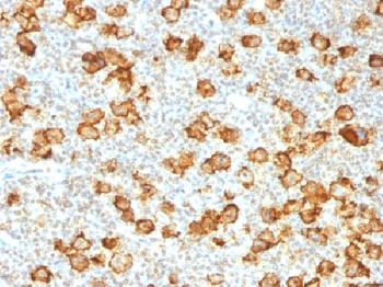 CD30 / TNFRSF8 Antibody