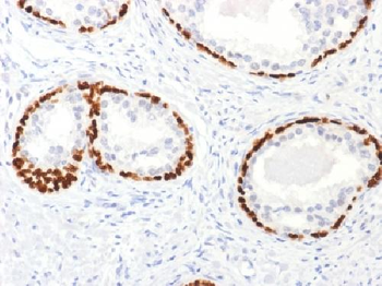 p63 Antibody