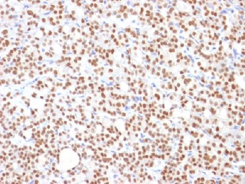 PAX8 (Renal Cell Marker) Antibody
