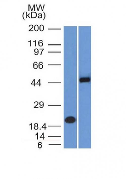 PAX8 (Renal Cell Marker) Antibody