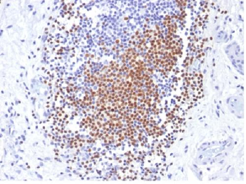 PAX8 (Renal Cell Marker) Antibody