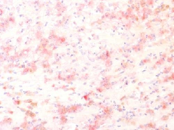 Tyrosinase-Related Protein-1 (TYRP-1) Antibody