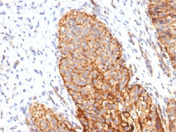 Thrombomodulin / CD141 Antibody