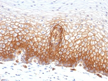 Thrombomodulin / CD141 Antibody
