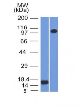 Thrombomodulin / CD141 Antibody