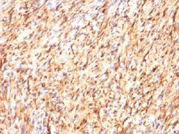 S100B Antibody