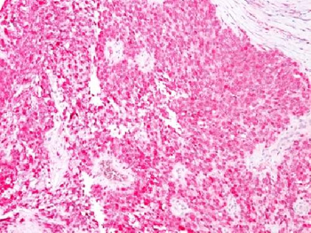 S100B Antibody