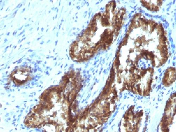 TDP2 / EAPII Antibody
