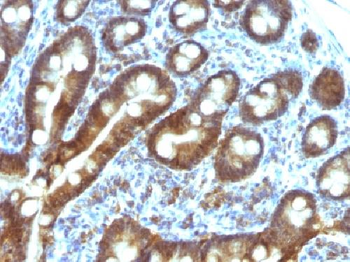 TDP2 / EAPII Antibody