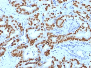 FOXA1 / HNF3A Antibody