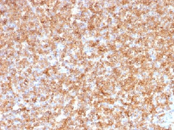 HLA-DP/-DQ/-DR (MHC II) Antibody