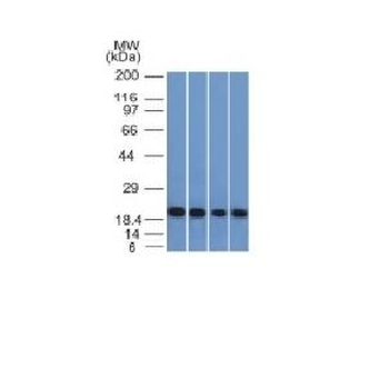 Ferritin, Light Chain (FTL) (Microglia Marker) Antibody