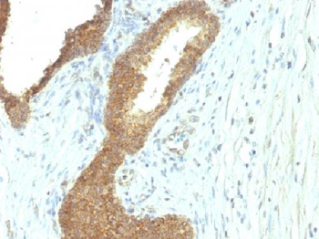 Alkaline Phosphatase (Tissue-Nonspecific) Antibody