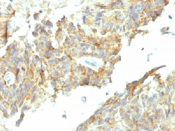 Alkaline Phosphatase (Tissue-Nonspecific) Antibody