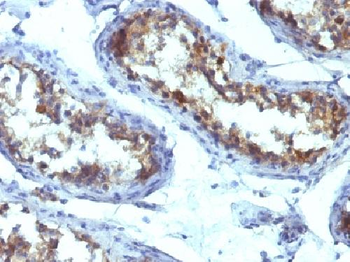 Alkaline Phosphatase (Tissue-Nonspecific) Antibody