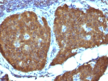 NSE gamma Antibody