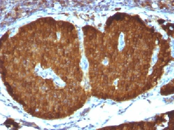 NSE gamma Antibody