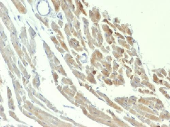 NSE gamma Antibody