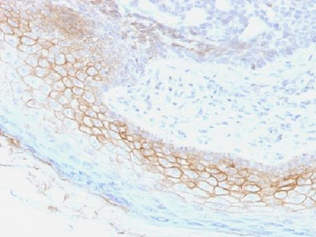 Desmocollin-2/3 Antibody