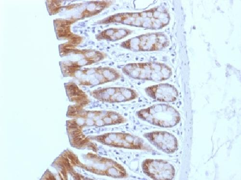 Catenin, beta (p120) Antibody