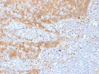 Catenin, beta (p120) Antibody