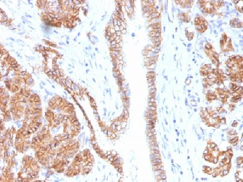 Catenin, beta (p120) Antibody