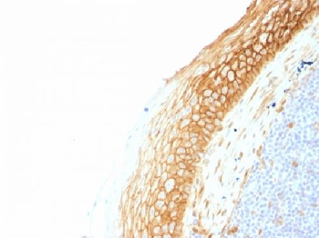 Catenin, beta (p120) Antibody