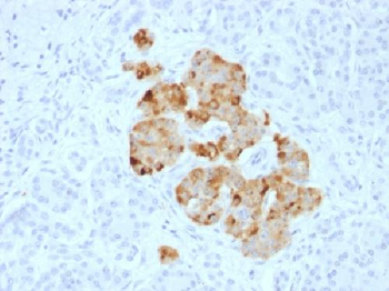 Chromogranin A / CHGA Antibody