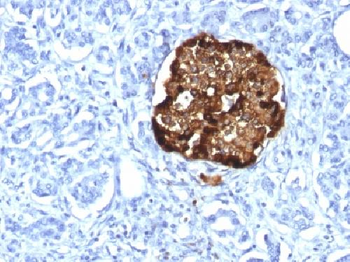 Chromogranin A / CHGA Antibody