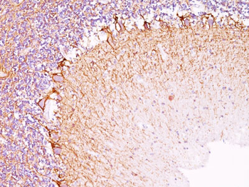 Neurofilament (H+L) (Neuronal Marker) Antibody - With BSA and Azide