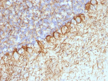 Neurofilament (H+L) (Neuronal Marker) Antibody - With BSA and Azide