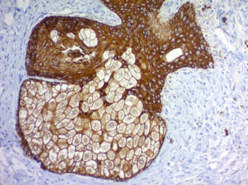Cytokeratin, pan (Epithelial Marker) Antibody - With BSA and Azide