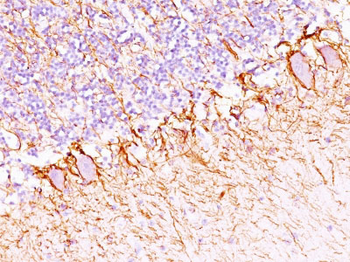 Neurofilament (H+L) (Neuronal Marker) Antibody - With BSA and Azide