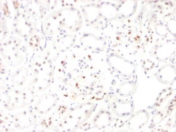 Wilm's Tumor 1 (WT1) (Wilm's Tumor & Mesothelial Marker) Antibody - With BSA and Azide