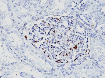 Wilm's Tumor 1 (WT1) (Wilm's Tumor & Mesothelial Marker) Antibody - With BSA and Azide